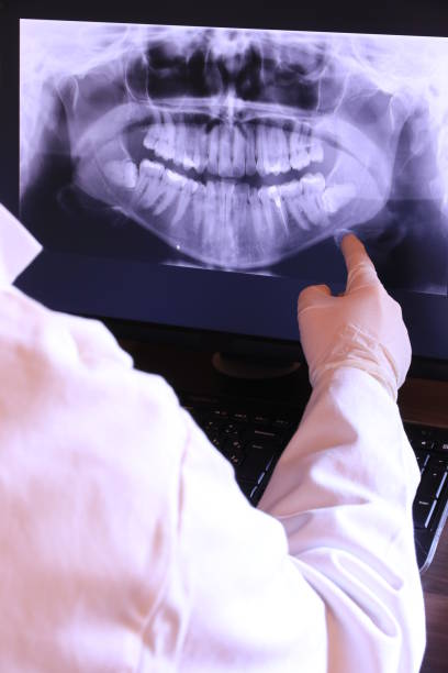 Best Emergency Treatment for Dental Infections or Abscesses in Casa Blanca, AZ